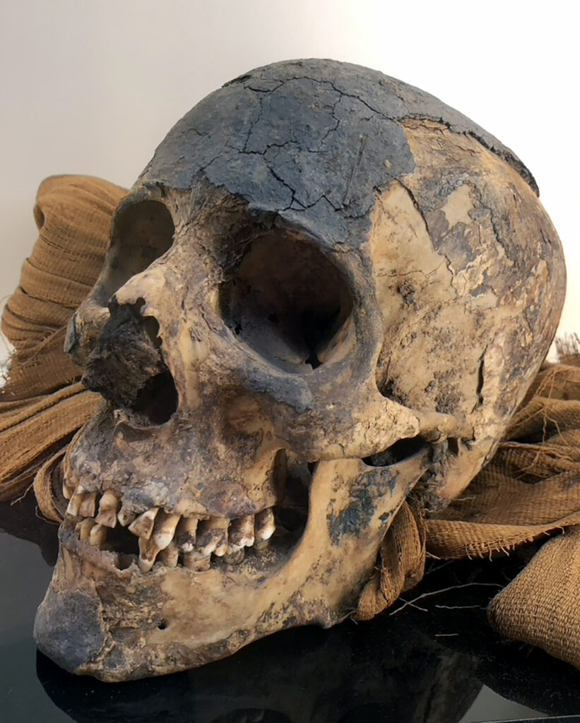 Egyptian mummy skull at Cazenovia Library by Michael Aaron Gallagher